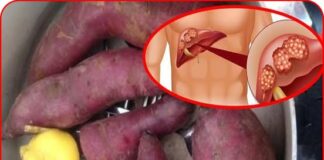 Ăn khoai lang hấp mỗi ngày, người phụ nữ hoảng hốt khi nhận kết quả khám gan: Sao lại như vậy được