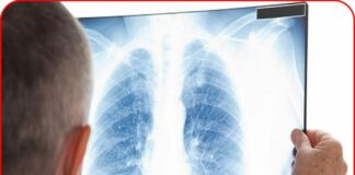 Bác sĩ cảnh báo: Ung thư phổi giai đoạn đầu không phải lúc nào cũng có ho, chú ý 4 bất thường này