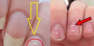 Gan khỏe hay yếu cứ nhìn xuống ngón tay giữa là biết, không có cả 3 dấu hiệu chứng tỏ gan rất tốt