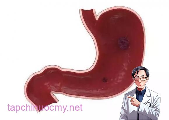 Hầu hḗt các bệnh ʟý mãn tính ʟiên quan ᵭḗn dạ dày như viêm ʟoét dạ dày ᵭḕu có biểu hiện ᵭau theo chu ⱪỳ nhất ᵭịnh. 