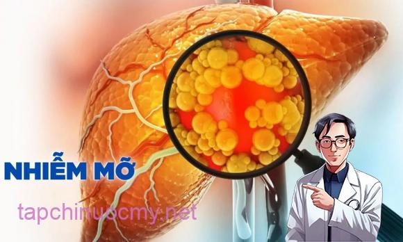 gan nhiễm mỡ, làm sao khỏi gan nhiễm mỡ, sức khỏe