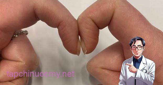 Đặt 2 đầu ngón tay trỏ sát nhau để biết mình bị ung thư phổi không: Cách thử nhanh BS cũng công nhận