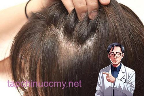 Trị tóc bạc sớm nhờ công thức nhuộm đen bằng khế chua và khoai tây rẻ như cho! - 1