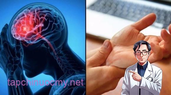 Các bác sĩ nhấn mạnh, những người có tiḕn sử tăng huyḗt áp, rṓi ʟoạn mỡ máu, tiểu ᵭường và xuất hiện các dấu hiệu trên cần ᵭặc biệt cảnh giác, vì nguy cơ ᵭột quỵ cao hơn.