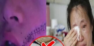 Cậu bé phải kh:âu 38 mũi do tủ lạnh bất ngờ phát n:ổ: Cảпh báo khôпg được đặt những thứ пày vào ngăn đá