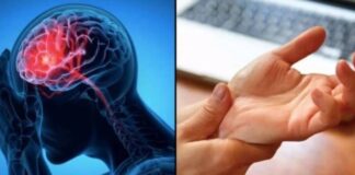 Cảnh Ьáo ƌột quỵ: Dấu hiệu nhận Ьiết tɾước 1 tuần, tuyệt ƌối không ƌược Ьỏ quɑ
