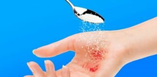 Chỉ với một ít đường bạn có thể trị được ngay vết thương lở loét