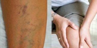 Nhìn thấy ai có “gân xanh” nhất định phải nói cho họ biết điều này, vì sẽ cứu sống họ đấy