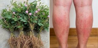Cây xấu hổ: công dụng và bài thuốc chữa bệnh được dân gian tin dùng