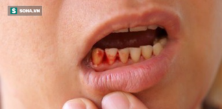 Ung thư đừng để quá muộn: BS viện Việt Đức cảnh báo 20 dấu hiệu nên đi khám ung thư