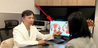 Người phụ nữ 55t có tử cung trẻ như gái 20, da mặt căng mịn: Tôi hay ăn 3 món, hóa ra rất tốt cho nội tiết