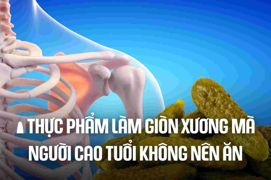 3 ʟoại nước ʟà 'vua rút cạn canxi, ᴜṓng nhiḕu xương giòn, dễ dàng
