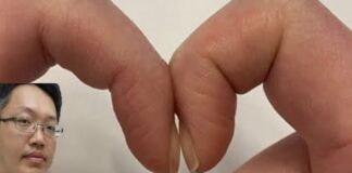 Đặt 2 đầu ngón tay trỏ sát nhau để biết mình bị ung thư phổi không: Cách thử nhanh BS cũng công nhận