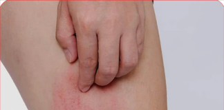 Hai bộ phận trên cơ thể ngứa ngáy là dấu hiệu của bệnh ung thư gan, nhiều người lại lầm tưởng là dị ứng