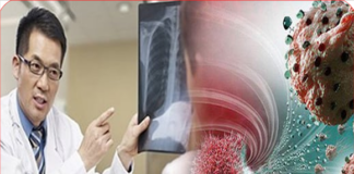 Sau nhiều năm, BS nhận ra bệnh nhân u;ng th;ư luôn có 6 điểm chung vào buổi sáng: Ngẫm lại quá đúng