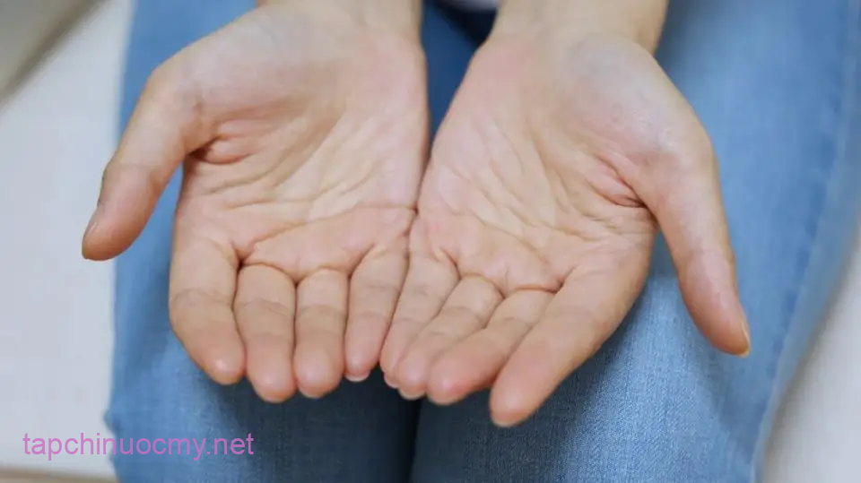 Dấu hiệu bệnh thận: 5 Vị trí ra mṑ hȏi cảnh báo sức khỏe nam giới - Ảnh 1.